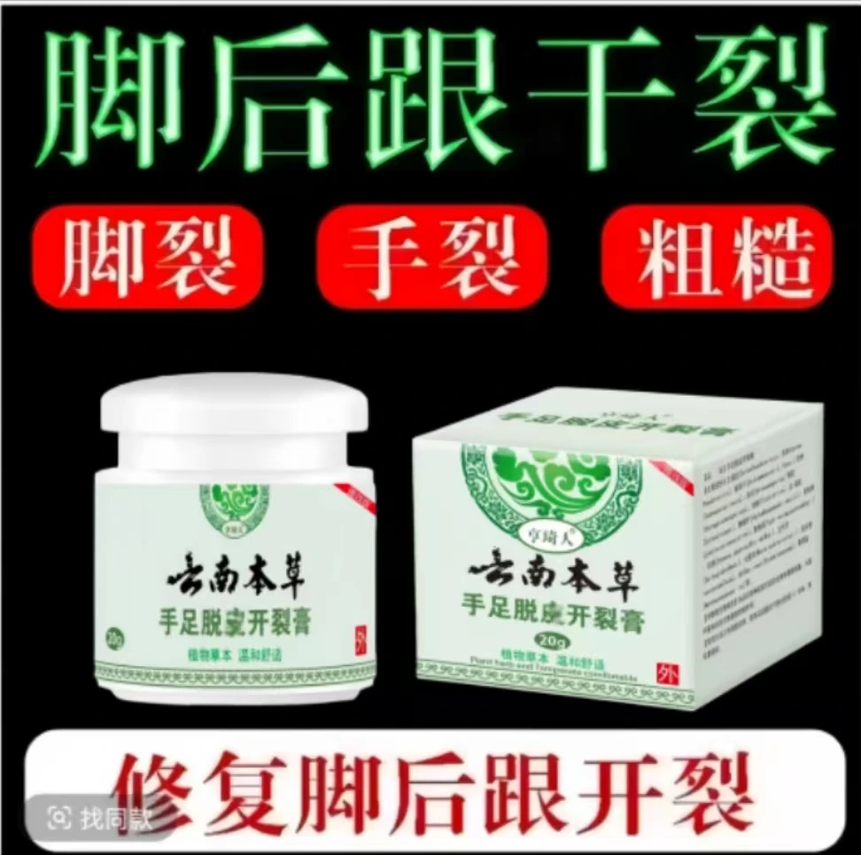 手指头裂口子干裂修复护手霜开裂脱皮裂开手足开口手脚草本皲裂膏