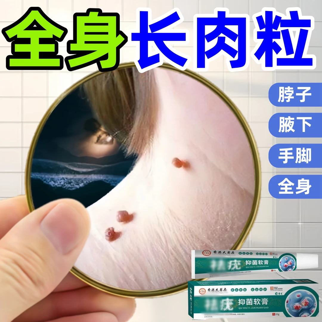 【小肉粒专用】主任推荐正品云南克尤膏脖子手足腋下丝状扁平肉刺