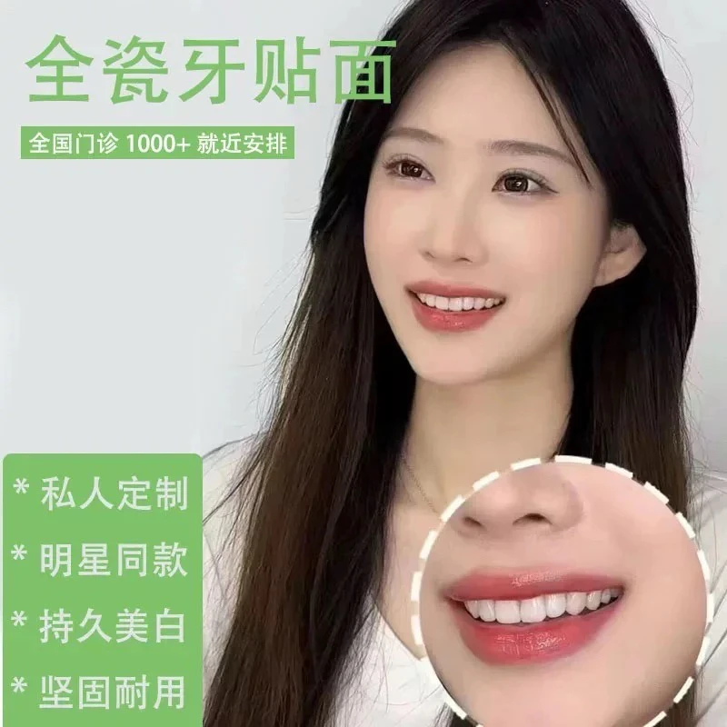 超薄全瓷美牙贴片明星同款