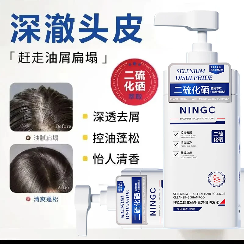 【官方正品】二硫化硒洗发水去屑止痒去屑控油蓬松留香功效型洗头膏