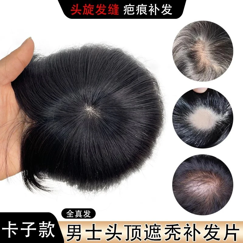 假发男头旋脱发全真人发丝补发片头顶稀少遮盖斑秃疤痕男士假发片