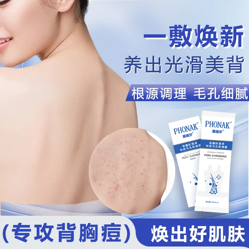 【祛痘补水】易瑞沙背胸祛痘膜改善前胸后背痘保湿控油护理舒缓