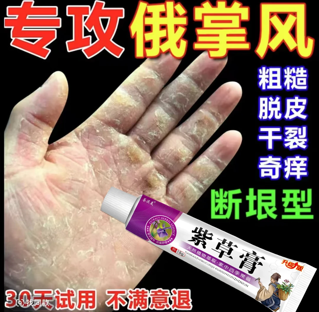 鹅掌风手部干裂脱皮手痒手裂口子手足起泡开口开裂起皮草本抑菌膏