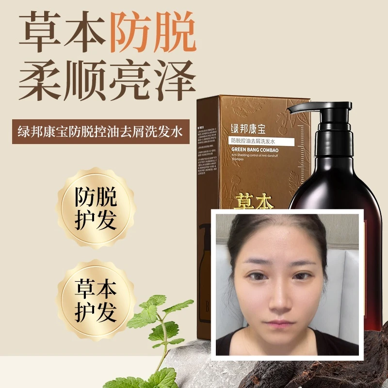 绿邦康宝防脱控油去屑洗发水针对掉发脱发大油头大头屑的人群