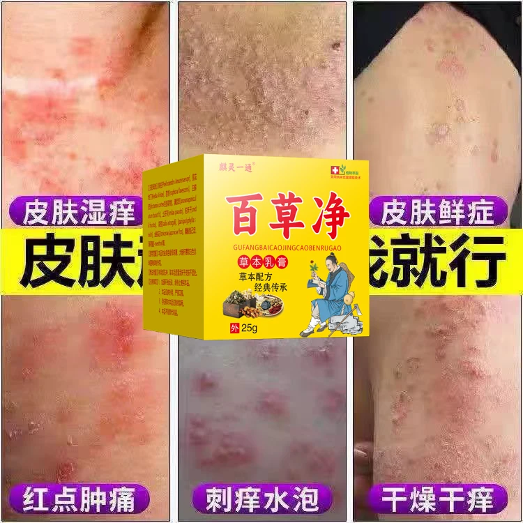 百草净草本植物萃取皮肤瘙痒止痒舒缓膏修护牛皮正品手足湿痒抑菌