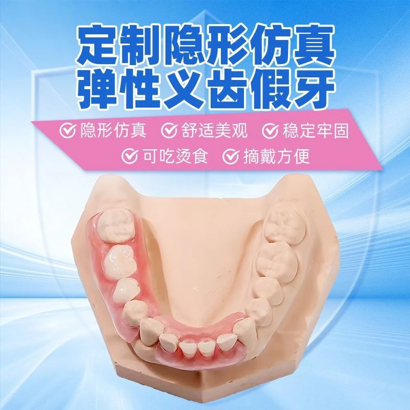 定制缺牙牙套隐形义齿门牙仿真假牙缺牙少牙镶牙义齿种植临时牙