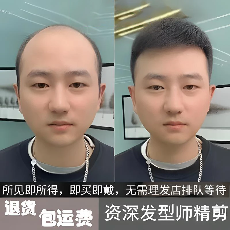 男士假发短发真发帅气隐形头顶补发块遮白发地中海秃头男士补发片