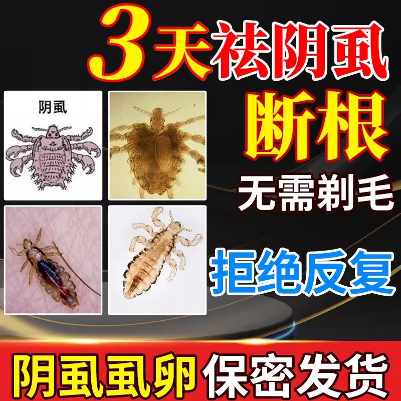 正品百部酊喷剂虱子虱卵一扫光不伤发肤温和不刺激阴虱是怎么来的