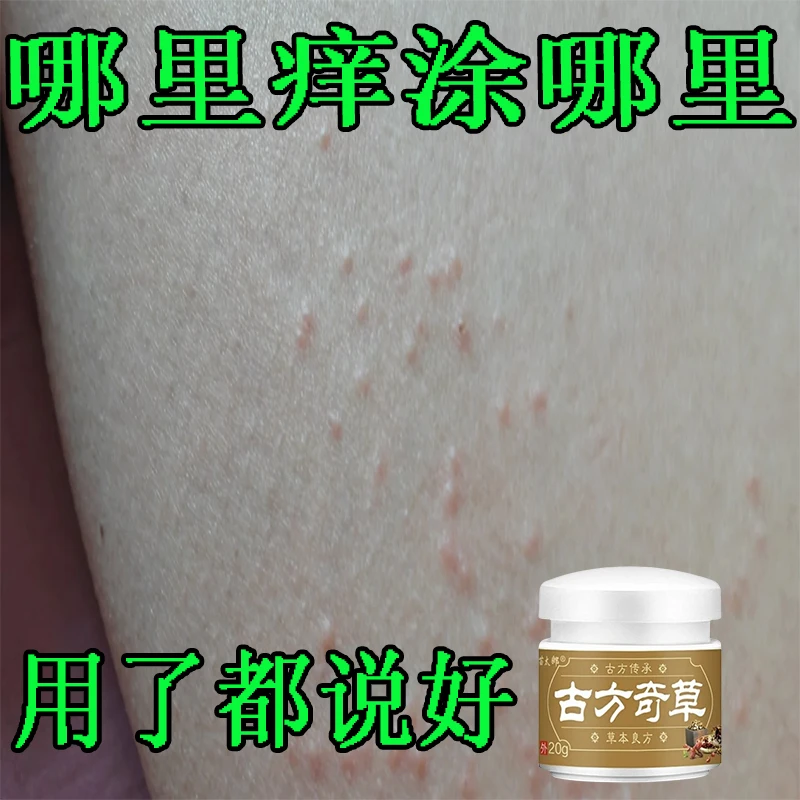 古方奇草草本全身止痒膏皮肤膏温和涂抹亲肤正品