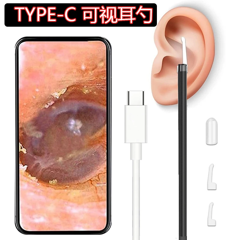 type-c高清可视耳勺内窥镜耳朵清洁器掏耳镜挖耳勺采耳工具仪神器