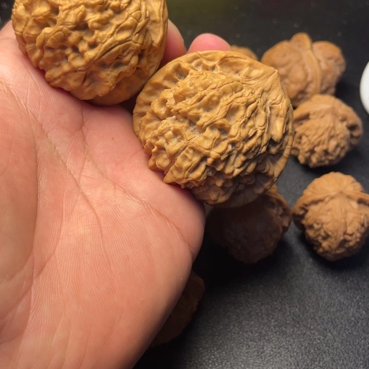 小***佑吊坠骨质密度绝对没问题