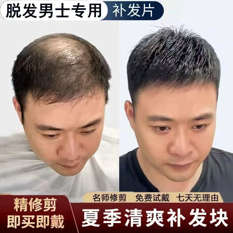 男士假发短发真发帅气隐形头顶补发片脱发遮地中海秃头男式补发片