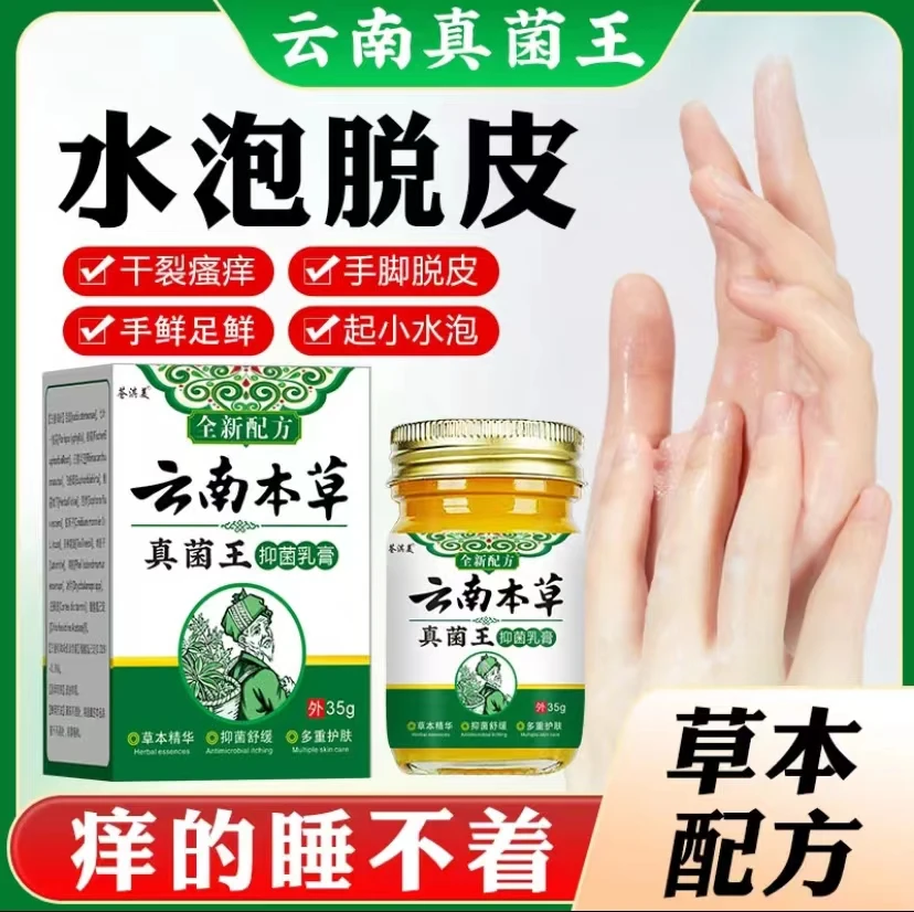 汗泡诊克星手上起小水泡止痒膏脱皮抑菌手指缝痒干裂专用草本乳膏