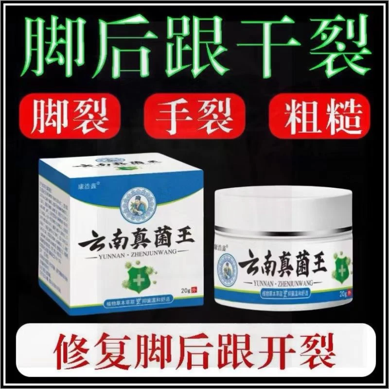云南真菌王手脚干裂膏全身皮肤问题可用脚干保湿草本温和抑菌乳膏