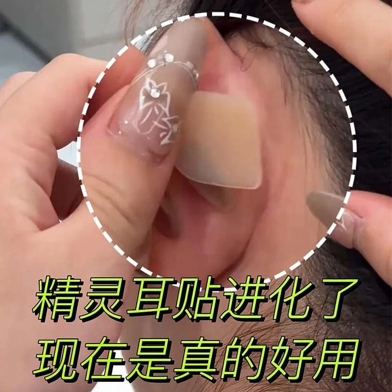 耳贴耳硅胶神器小芯片款支撑龙骨招风耳哑光级定型贴隐形贴面精灵