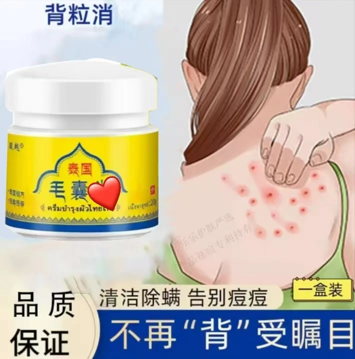 身上毛囊痘痘胸前背上又痒又痛红肿反复用草本毛囊软膏