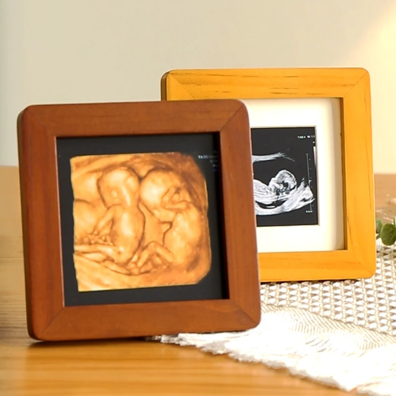 宝宝洗照片打印加相框diy定制四维照片相框摆台儿童周岁礼物