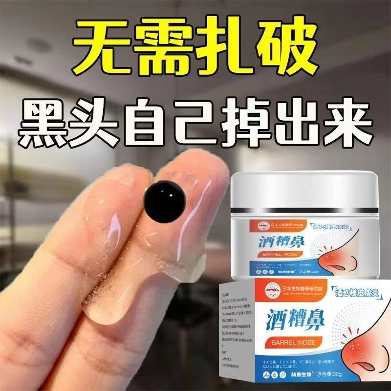 酒渣鼻修护红鼻子鼻头草莓鼻大鼻子去污