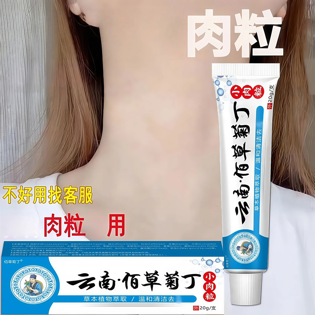 【小肉粒专用】正品去脖子肉粒疙瘩丝状扁平寻常肉刺手足腋下膏