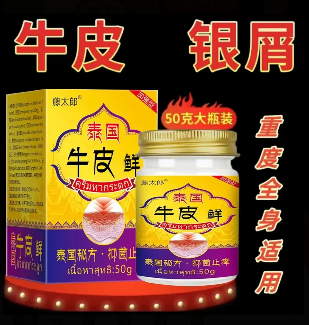 牛专用皮膏顽固王银止痒屑膏体股抑菌喷剂皮肤痒草本止痒膏神器