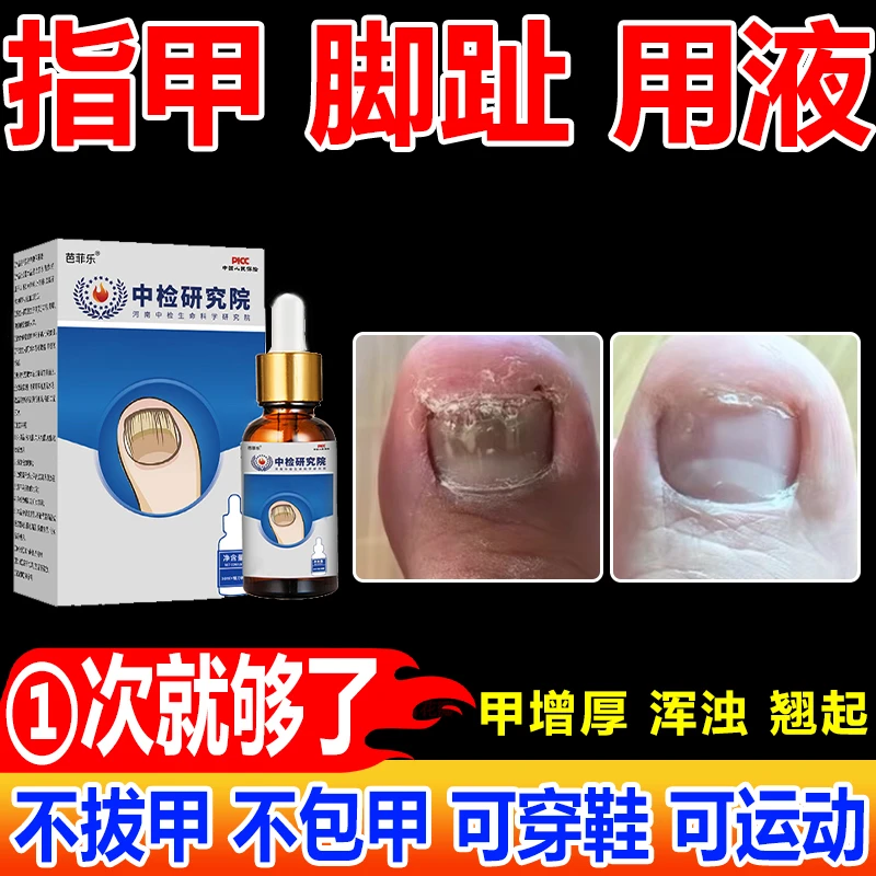 灰趾指甲灰脚趾甲专用抑菌液正品水凤仙花指甲手指脚趾甲变灰色