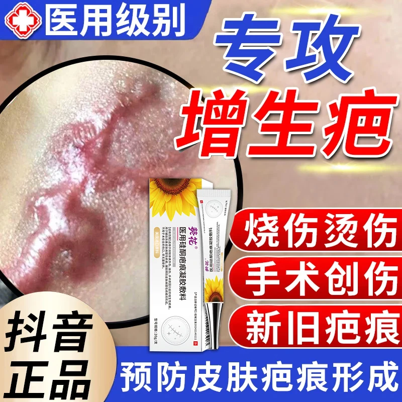 疤痕膏辅助预防疤痕的形成术后增生疤烧烫伤疤疤痕修复葵花医用硅酮疤痕凝胶敷料