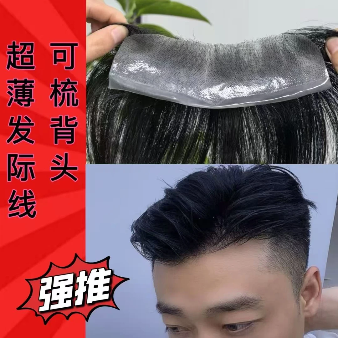 男士M型深V形发际线真发假发贴前额隐形无痕补发片