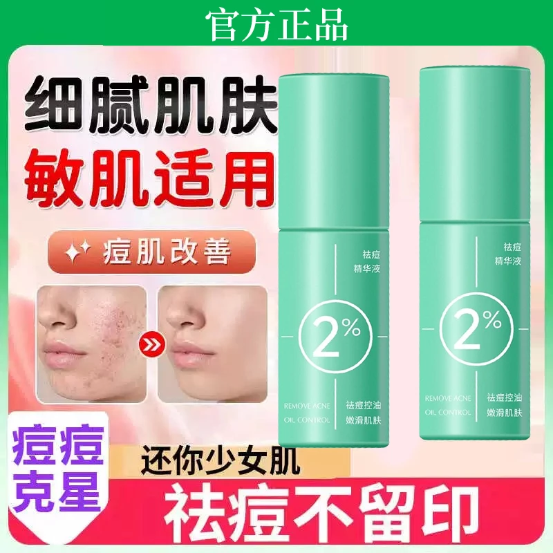 柔酸祛痘精华液淡化痘印去闭口粉刺痘痘收缩毛孔控油痘肌男女正品