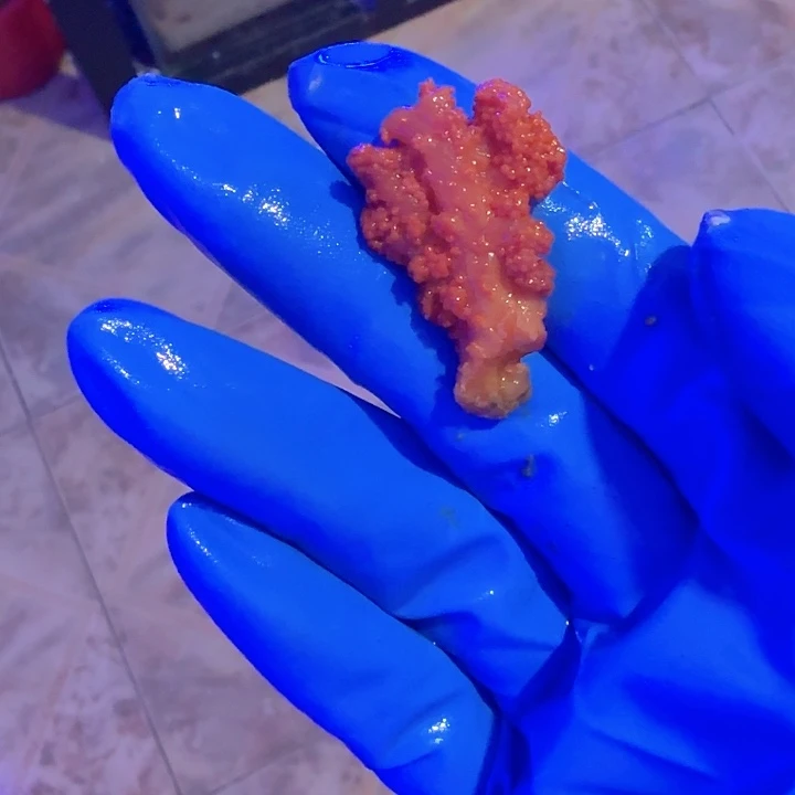 李***勇纽扣珊瑚太阳花11111