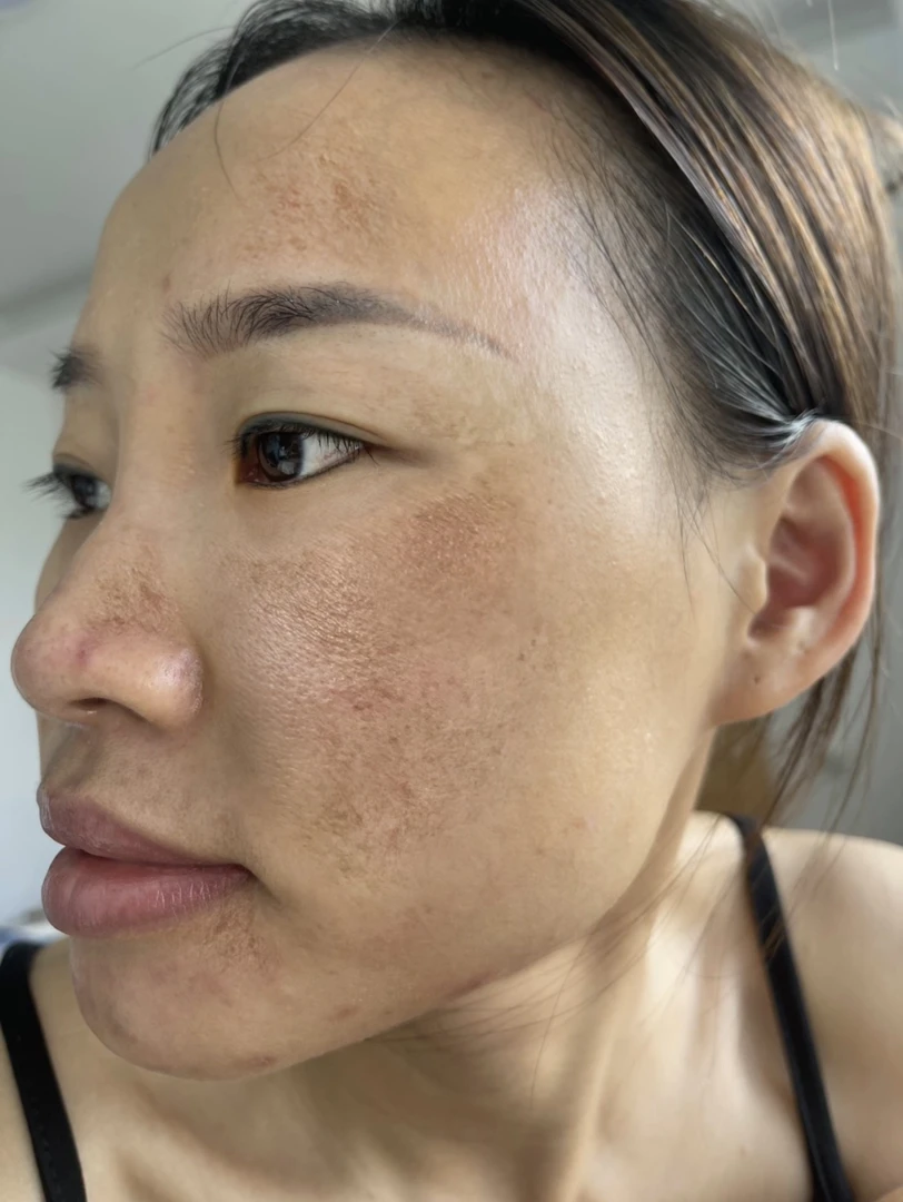看主播以前的照片  皮肤