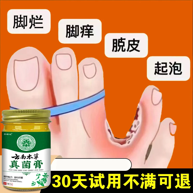 真菌王手脚起小水刨止痒膏脚趾缝真菌感染抑菌开裂止痒神器软膏