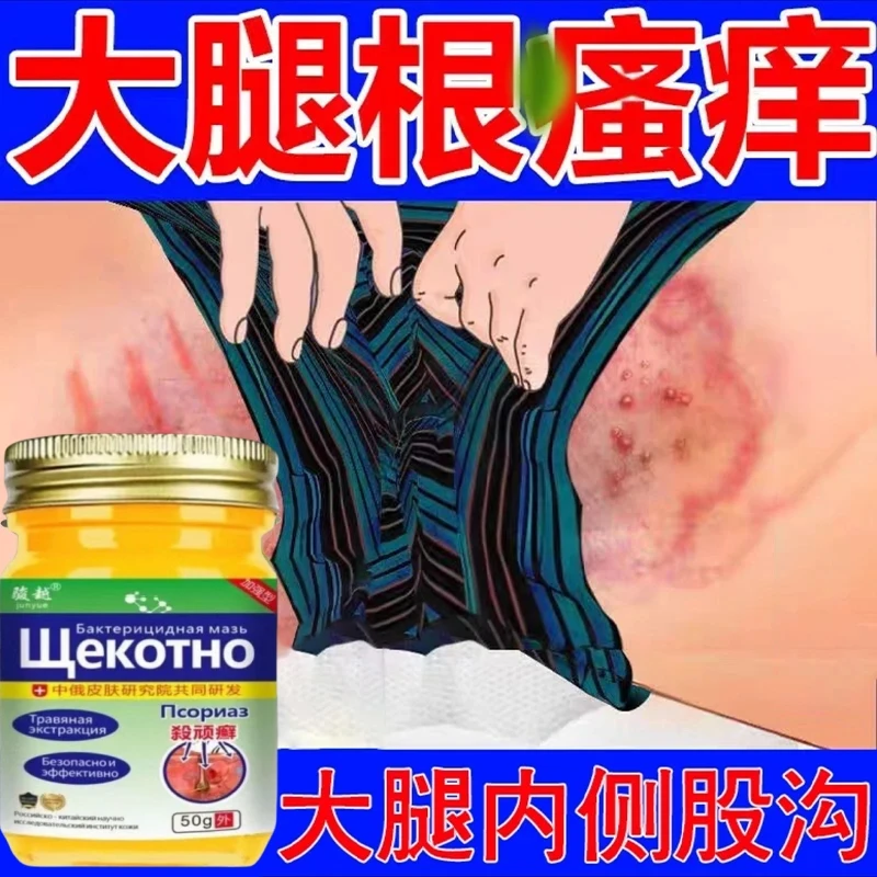 大腿内侧发红发黑长痘痘疙瘩腹股沟痒大腿根痒止痒私处真菌王乳膏