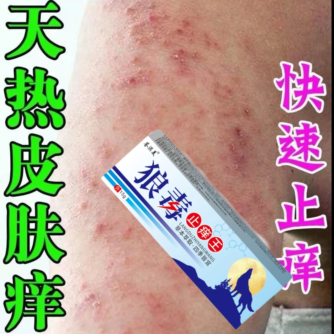 皮肤湿毒痒特效药腿干燥瘙痒湿痒止痒膏春夏越抓越痒出血起红疙瘩