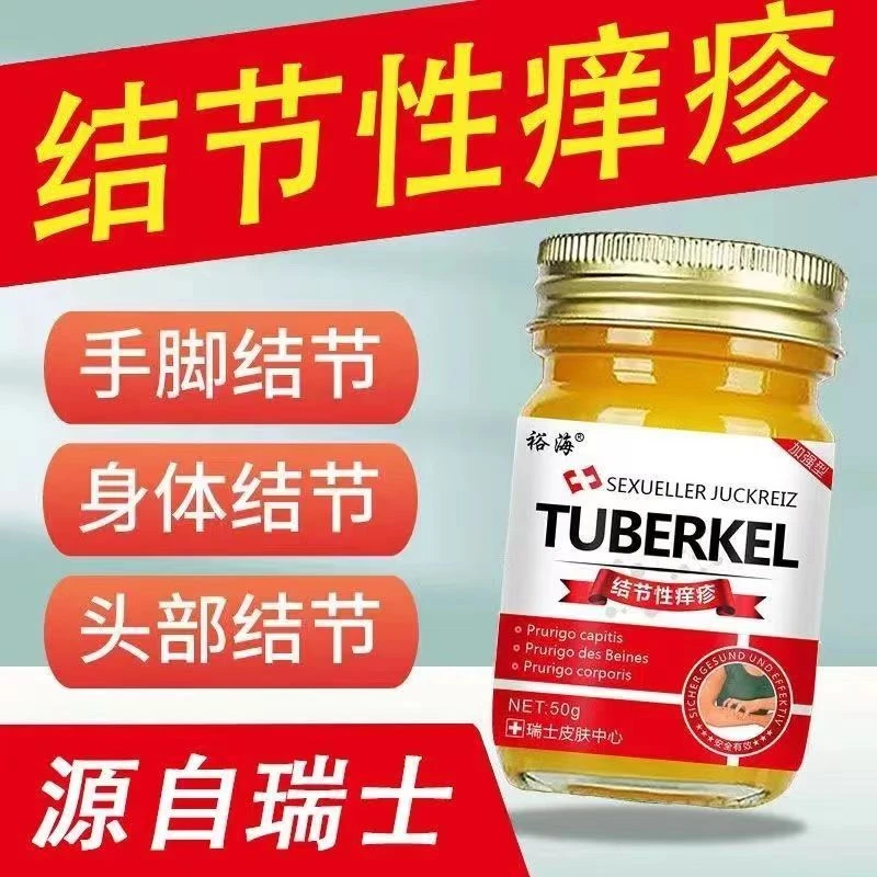 结节性痒疹止痒顽固性皮焱疙瘩湿诊腿部红斑痘痘湿痒止痒皮肤乳膏