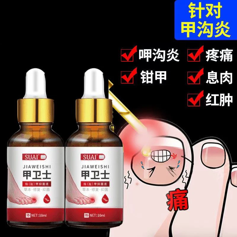 【指甲不扎肉】甲沟肿大有脓/包脚指甲化/脓 扎肉脚趾头专用甲沟液