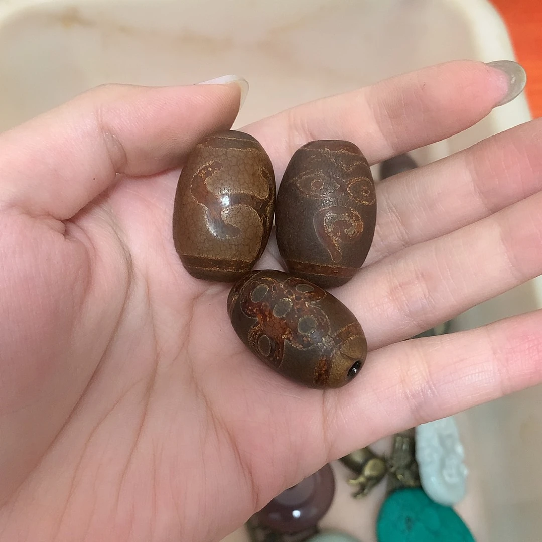 玛瑙/玉髓颈饰合金生***理