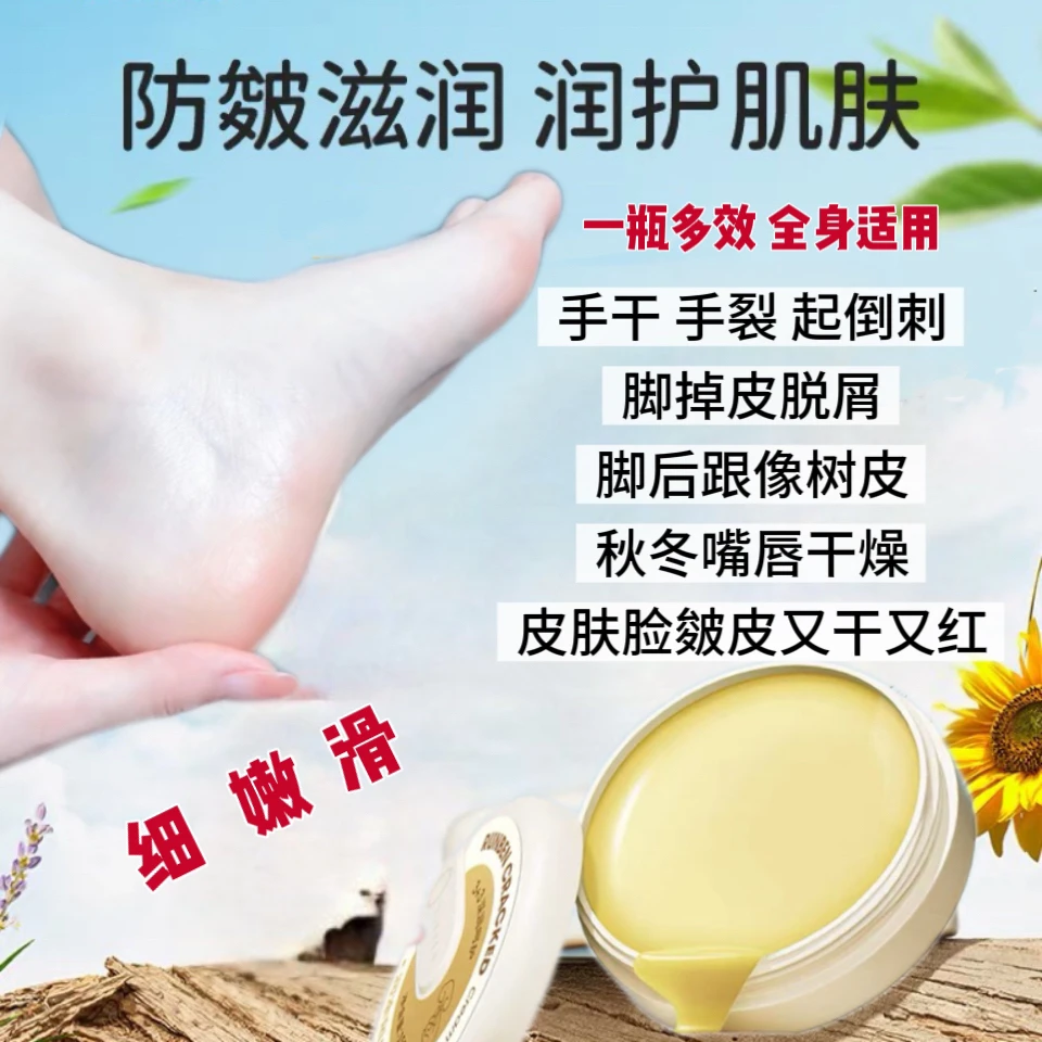 大姐董子嘉专属【皴列膏】手脚干裂起皮护手护足霜秋冬滋润保养保湿