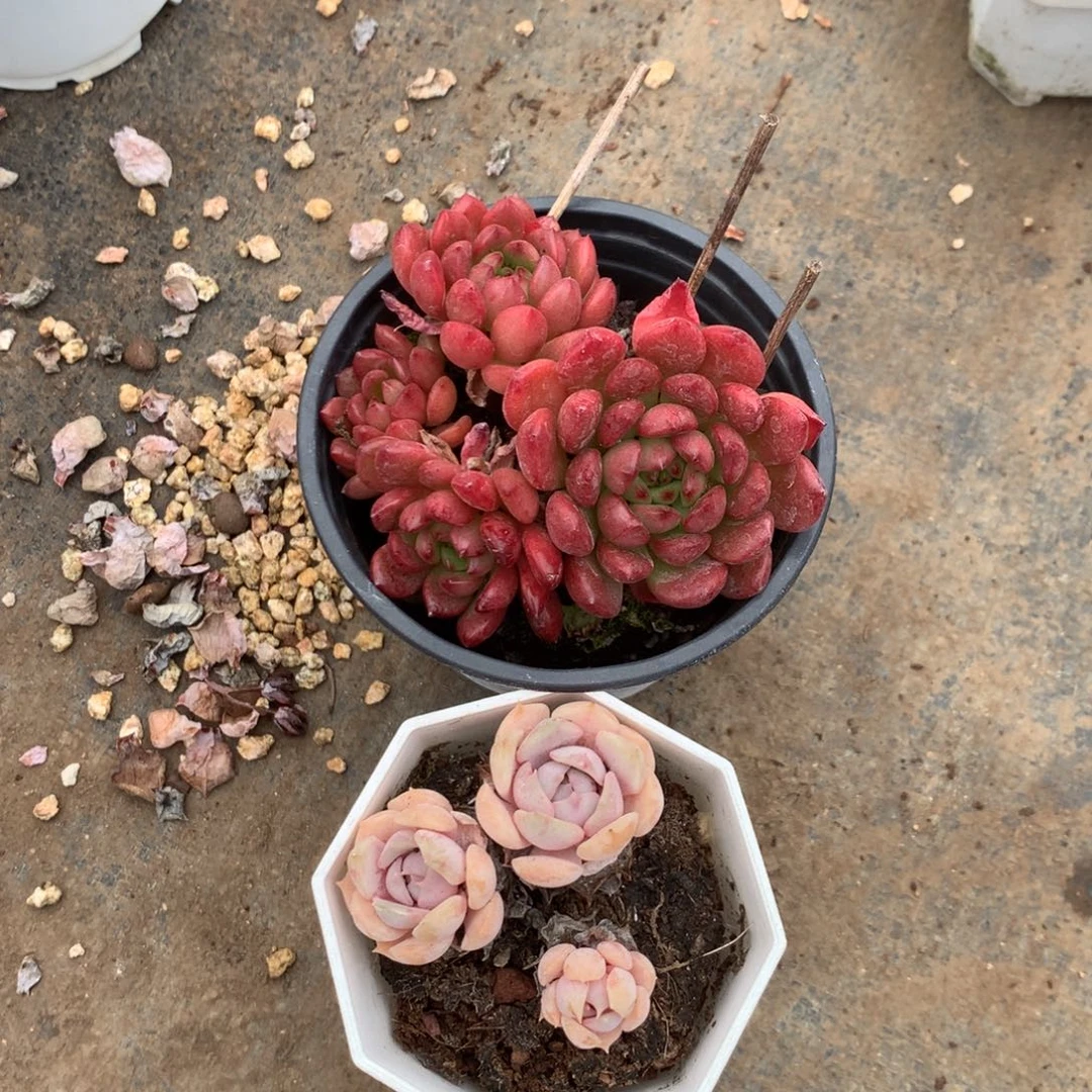 人工关节治疗和各种风湿