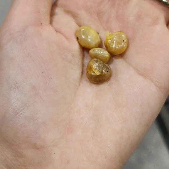 完全开放比较接近见见你