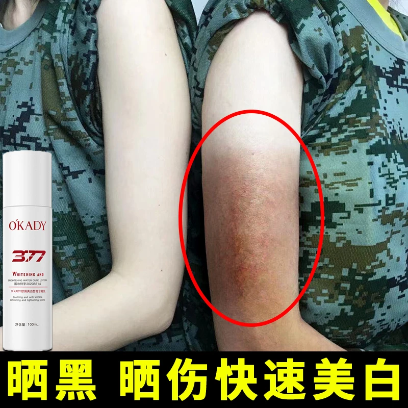 晒黑了修复怎么快速变白最快最简单的方法美白回来洗白神器女男士