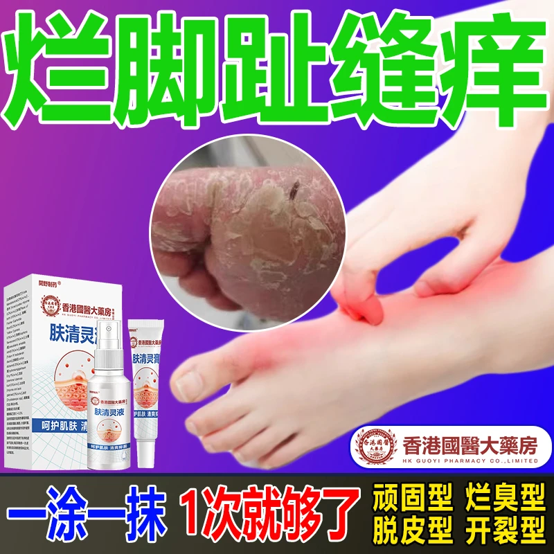 脚痒脚臭止痒膏去脚出汗脱皮起水泡干裂脚趾缝痒喷剂抑菌止痒神器