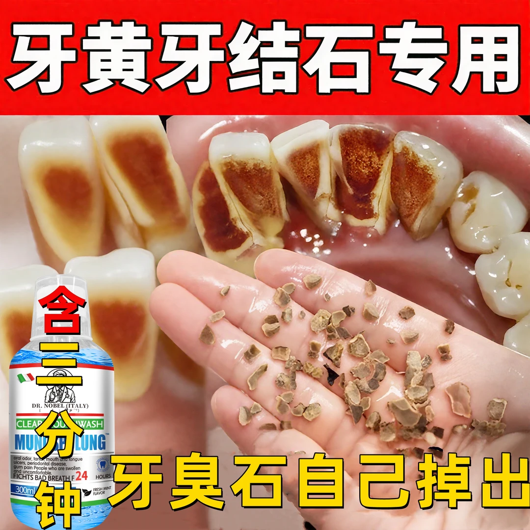 【溶解口腔异味】漱口水去口臭清理牙垢牙渍清洁黄牙神器分解牙抑菌