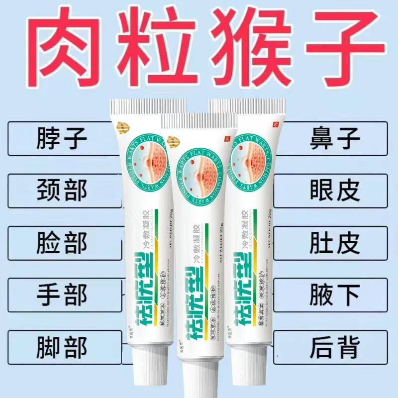 身上长肉粒皮赘脖子腋手足下小寻常疙瘩自然脱落冷敷凝胶
