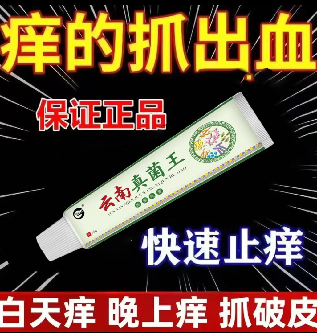 【痒的受不了】云南真菌王乳膏全身各种痒止痒克星皮肤止痒乳膏