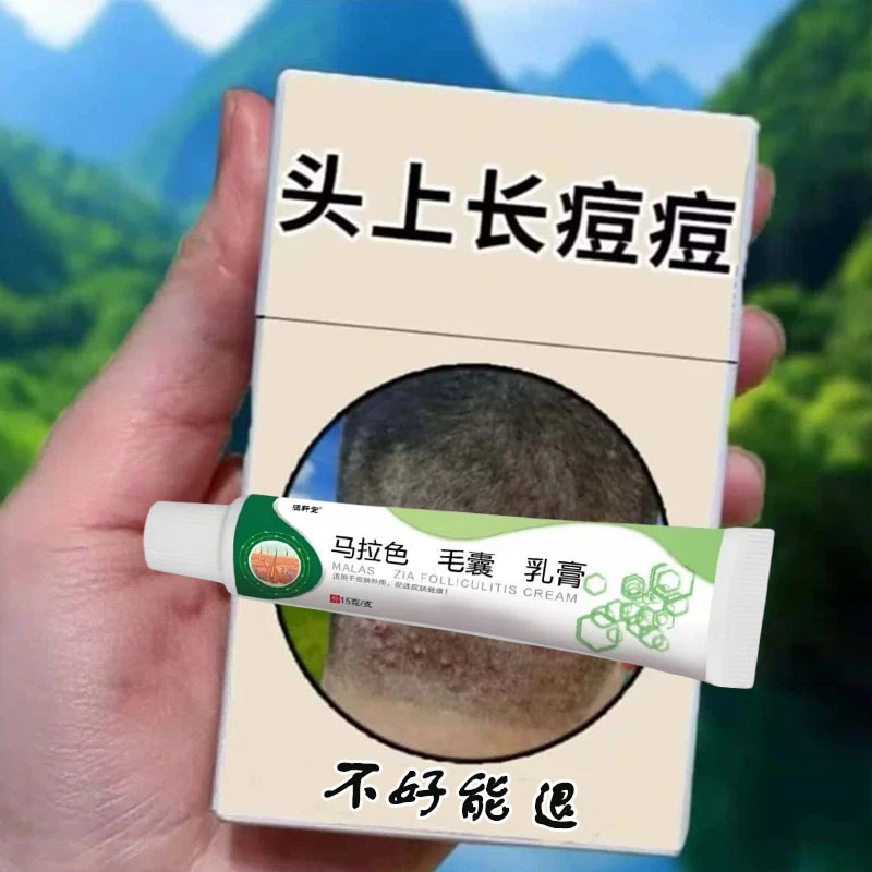 正品头皮有疙瘩豆豆专用头皮抓痒草本萃取块痒红i肿毛囊全身通用