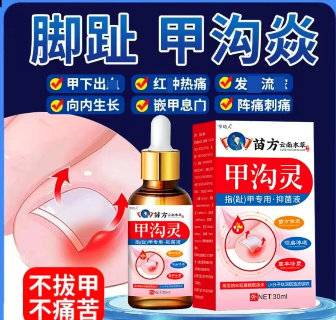 指甲长肉里软甲脱甲脚趾甲化脓嵌甲肉芽脚指头疼甲沟草本护理膏