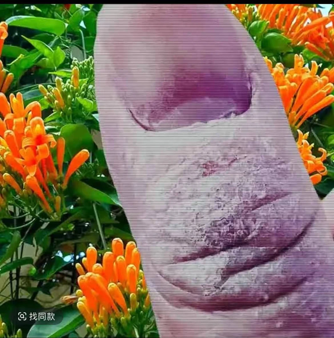 手指关节干燥裂口手指关节长硬疙瘩脱皮顽固干裂痒掉皮抑菌软膏
