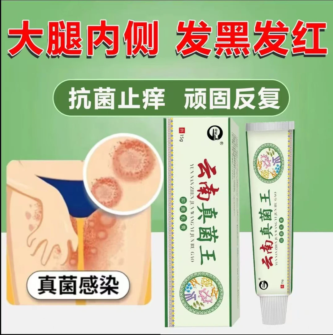 【顽固】大腿内侧瘙痒湿痒两侧发红发黑长疙瘩私处皮肤瘙痒止痒膏