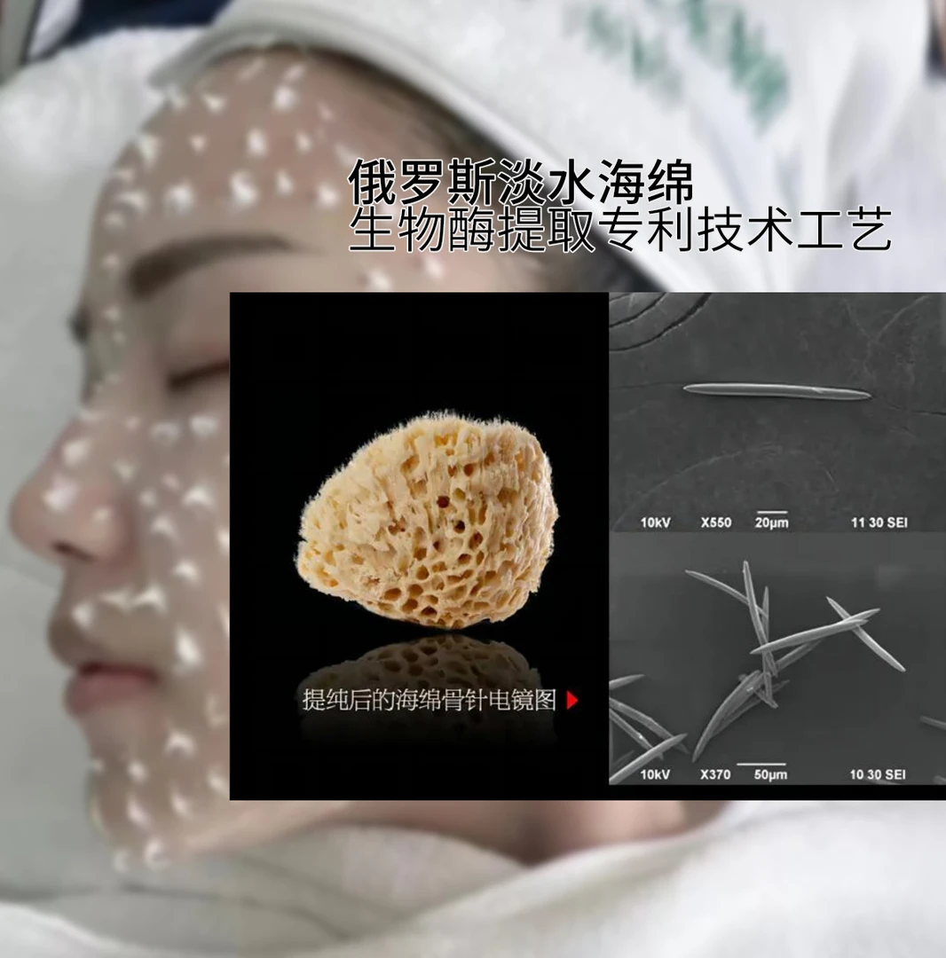 99%高纯度俄罗斯淡水海绵骨针-美容院拓客微晶霜（改善痘痘闭口）