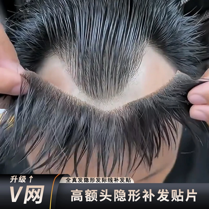 男士前额m型发际线假发贴男全真发无痕生物头皮刘海补发片高额头